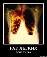 РАК ЛЕГКИХ просто рак