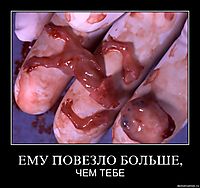 ЕМУ ПОВЕЗЛО БОЛЬШЕ, ЧЕМ ТЕБЕ
