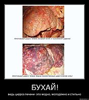БУХАЙ! ведь цирроз печени- это модно, молодёжно и стильно