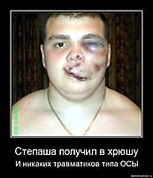 Степаша получил в хрюшу И никаких травматиков типа ОСЫ