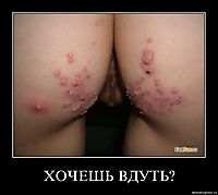 ХОЧЕШЬ ВДУТЬ? 