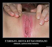 ГЛЯНЬТЕ, ШОТА В ГЛАЗ ПОПАЛО гляньте, шота в глаз попало