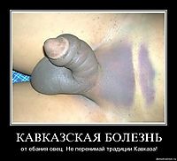 КАВКАЗСКАЯ БОЛЕЗНЬ от ебания овец. Не перенимай традиции Кавказа!