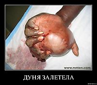 ДУНЯ ЗАЛЕТЕЛА 