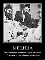 МЕЦИЦА (отсасывание могелем крови из члена обрезанного еврейского младенца