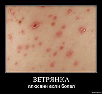 ВЕТРЯНКА плюсани если болел