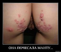 ОНА ПОЧЕСАЛА МАНТУ... 