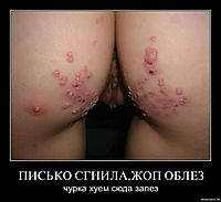 ПИСЬКО СГНИЛА,ЖОП ОБЛЕЗ чурка хуем сюда залез