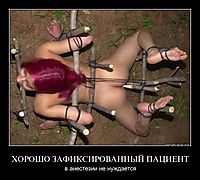 ХОРОШО ЗАФИКСИРОВАННЫЙ ПАЦИЕНТ в анестезии не нуждается