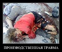 ПРОИЗВОДСТВЕННАЯ ТРАВМА 