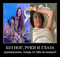 БЕЗ НОГ, РУКИ И ГЛАЗА укропатриотка, теперь то тебе не смешно?