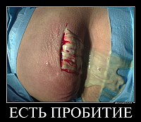 ЕСТЬ ПРОБИТИЕ 